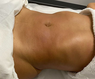Lymphatic Massage